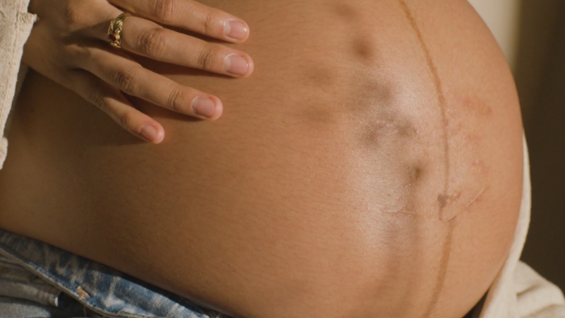 Trudnički stomak sa blagim tragovima strija tokom trudnoće